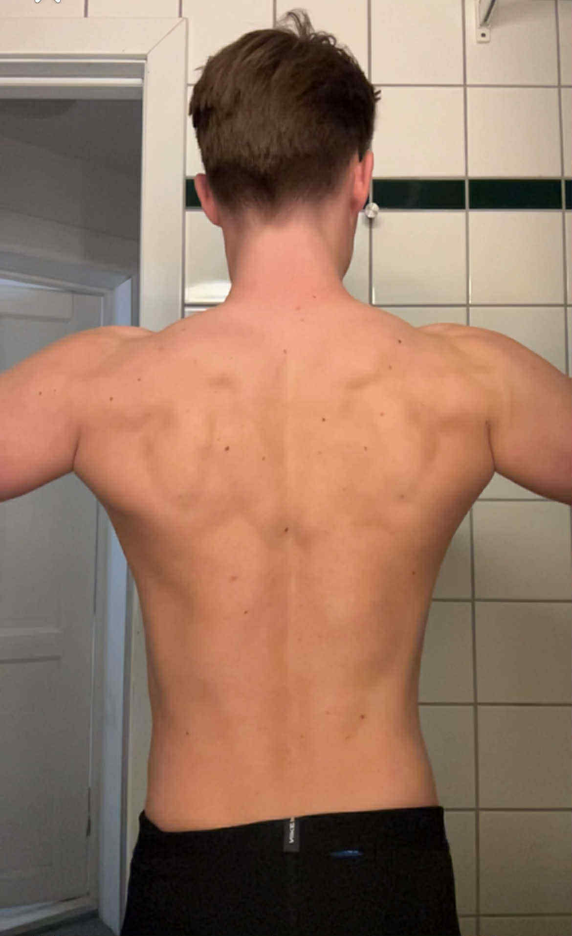 Anton before transformation